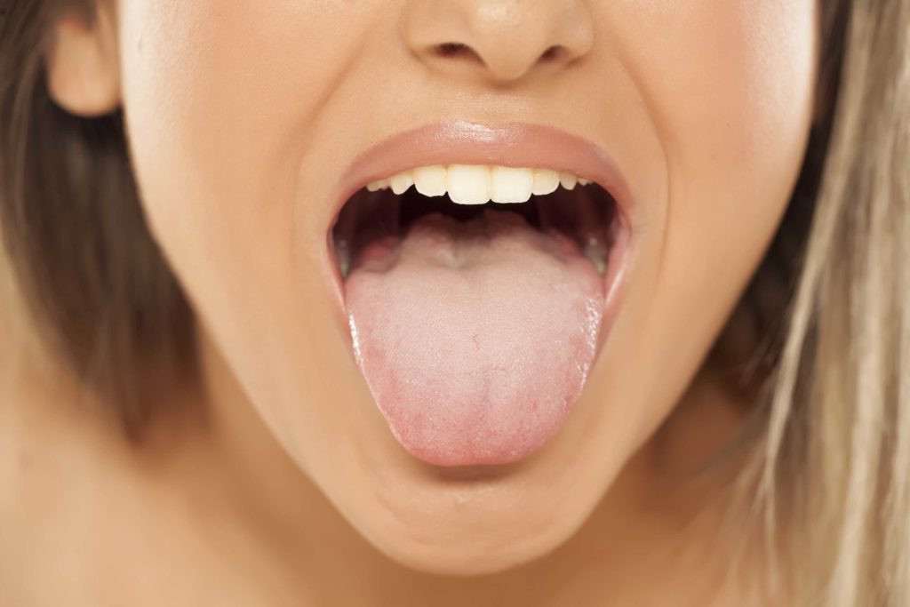 Tongue-Tied? Periodontist Discusses Benefits of a Laser Frenectomy in Towson