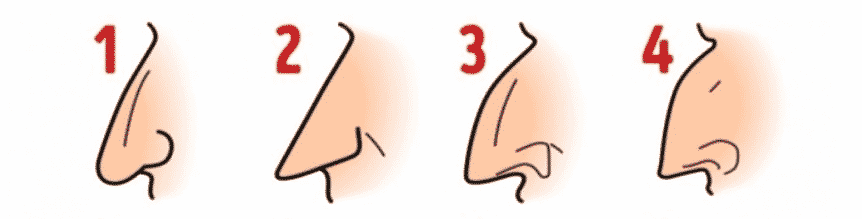 nose shapes1-4