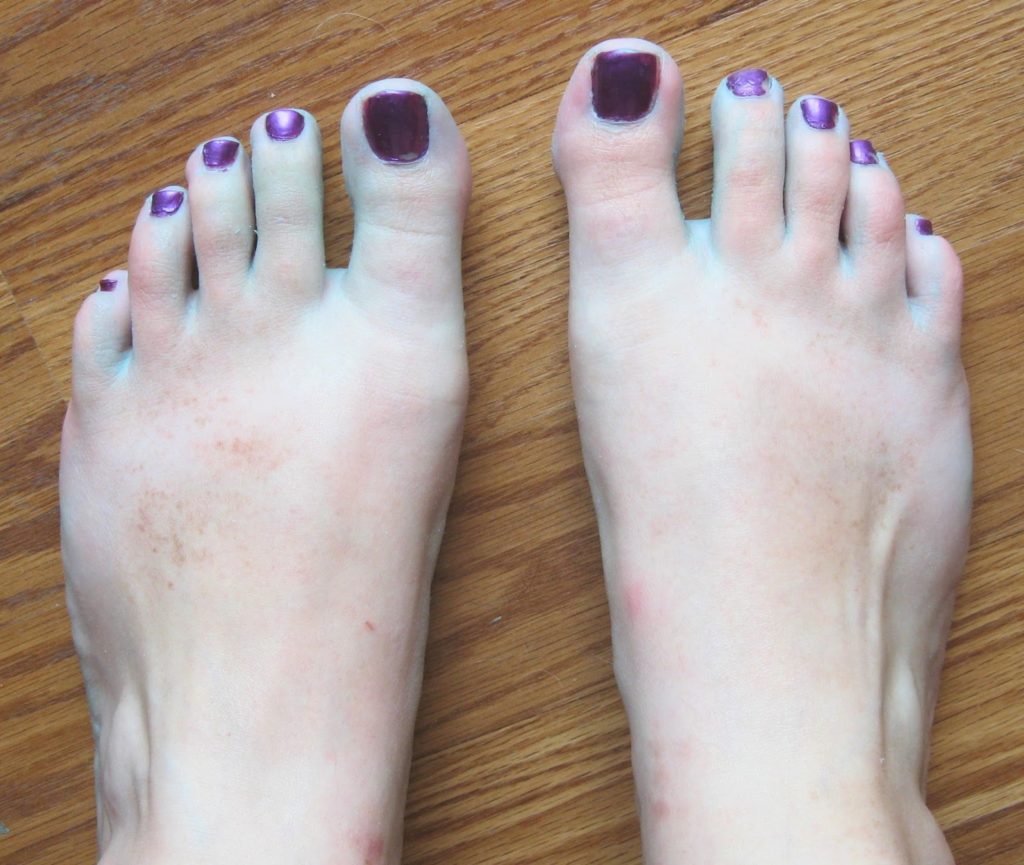 feet with purple nail polish