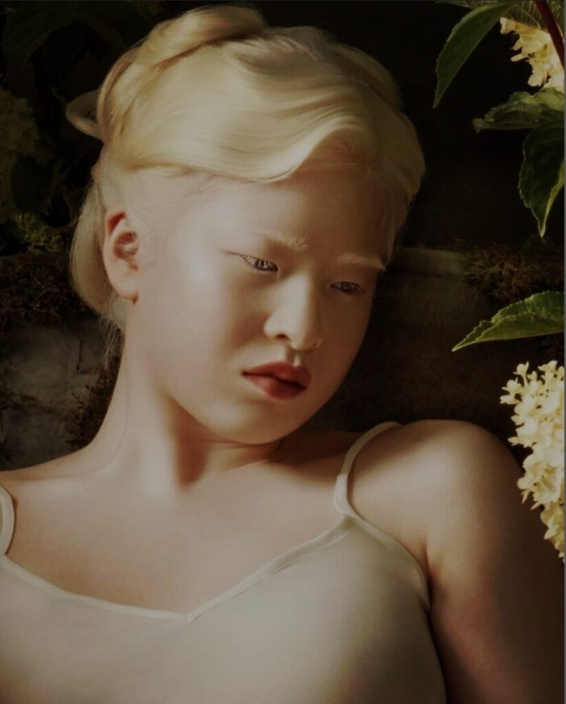 albino-girl